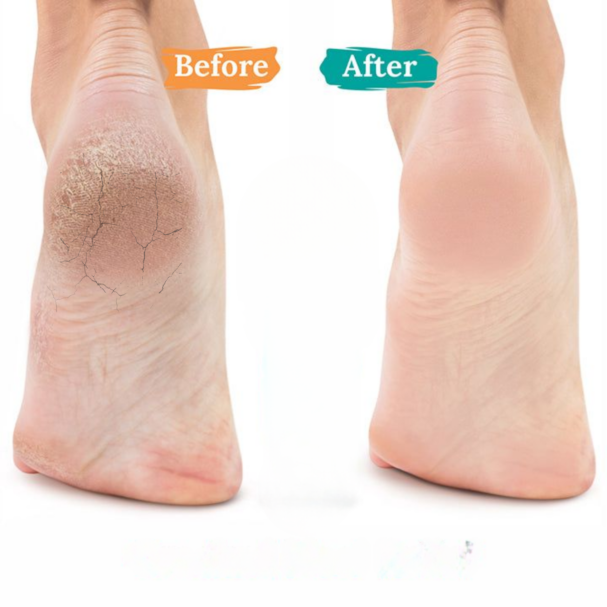 Complete Foot Care Cream