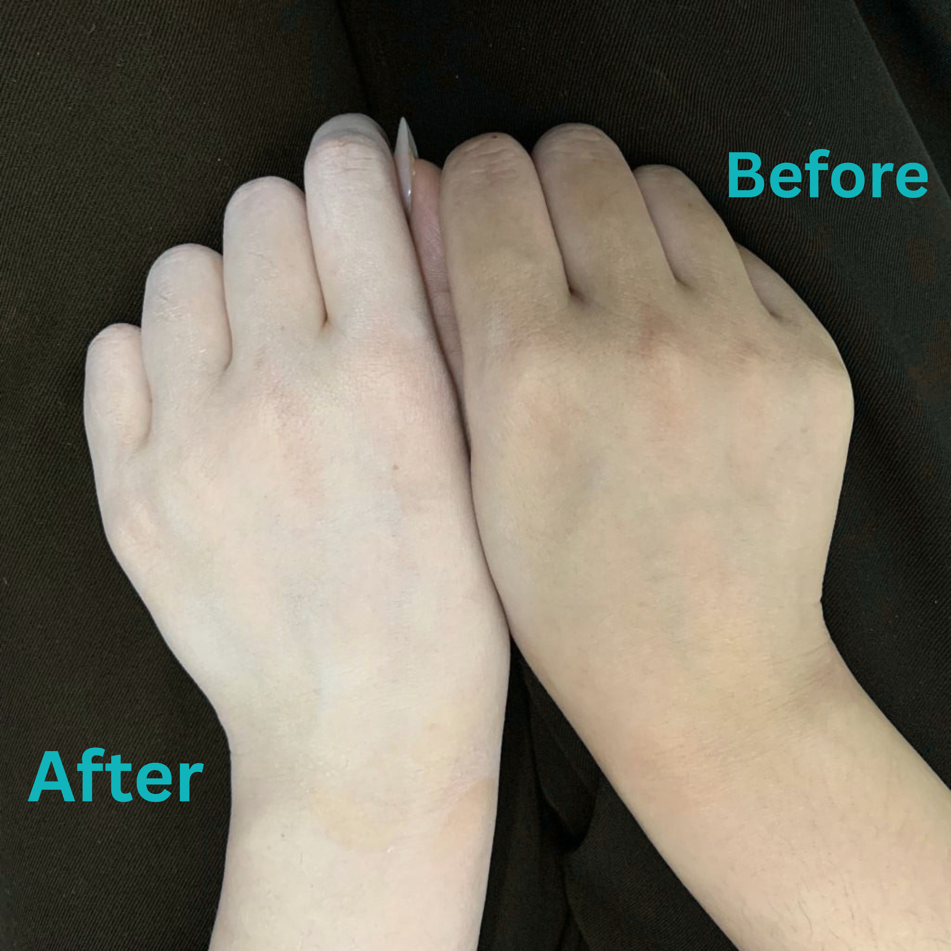 Diabetic Hand Cream