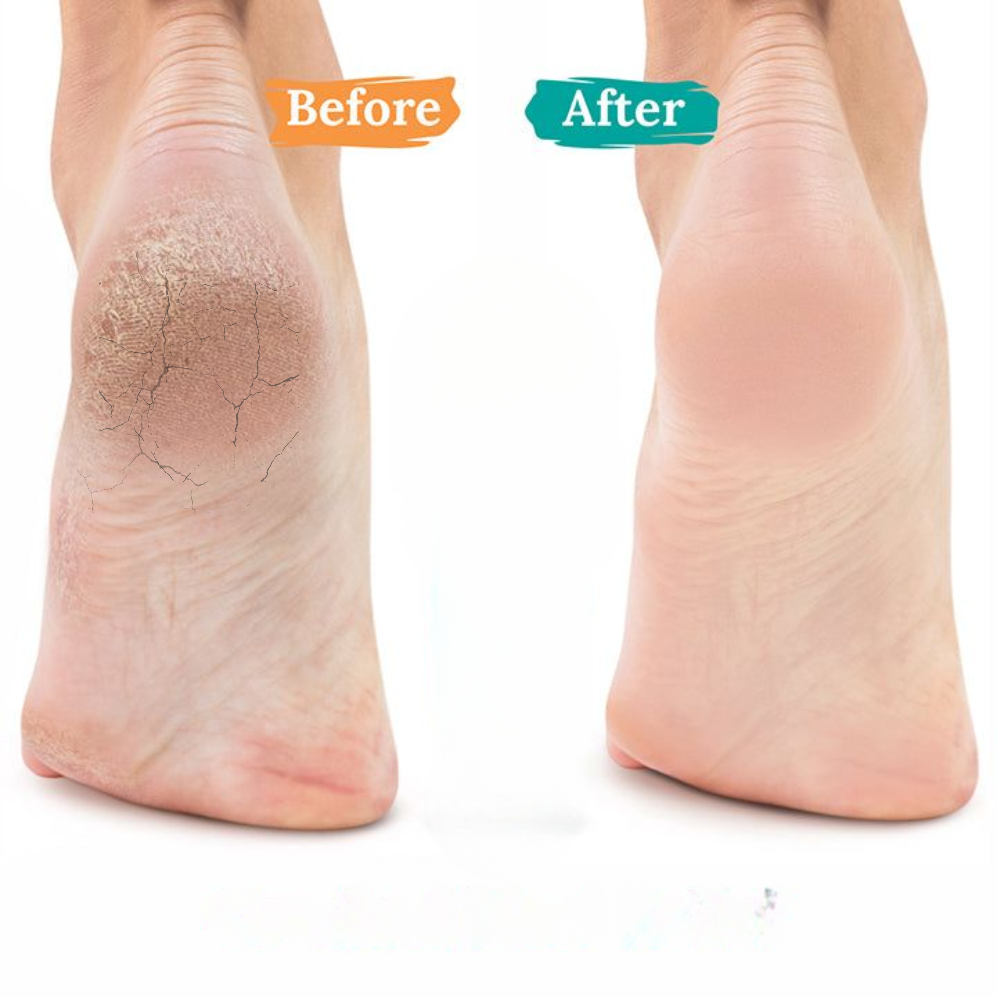 Complete Foot Care Cream