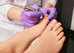 Fungal Nail Infection