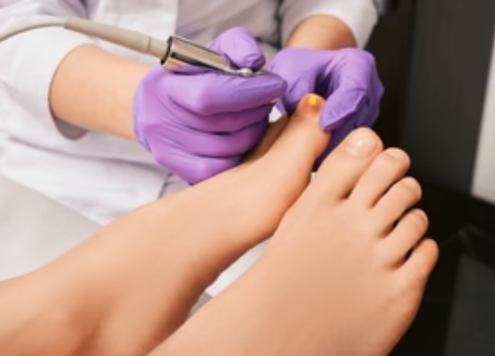 Fungal Nail Infection